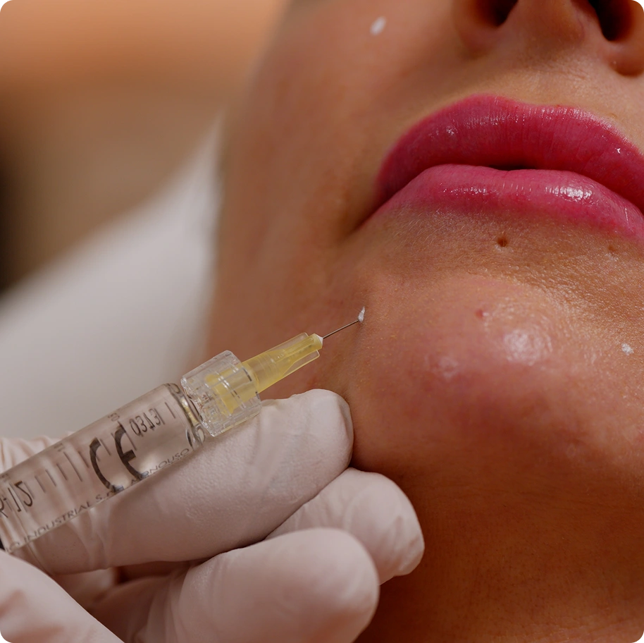 About Wrinkle Relaxing Injection About Wrinkle Relaxing Injection